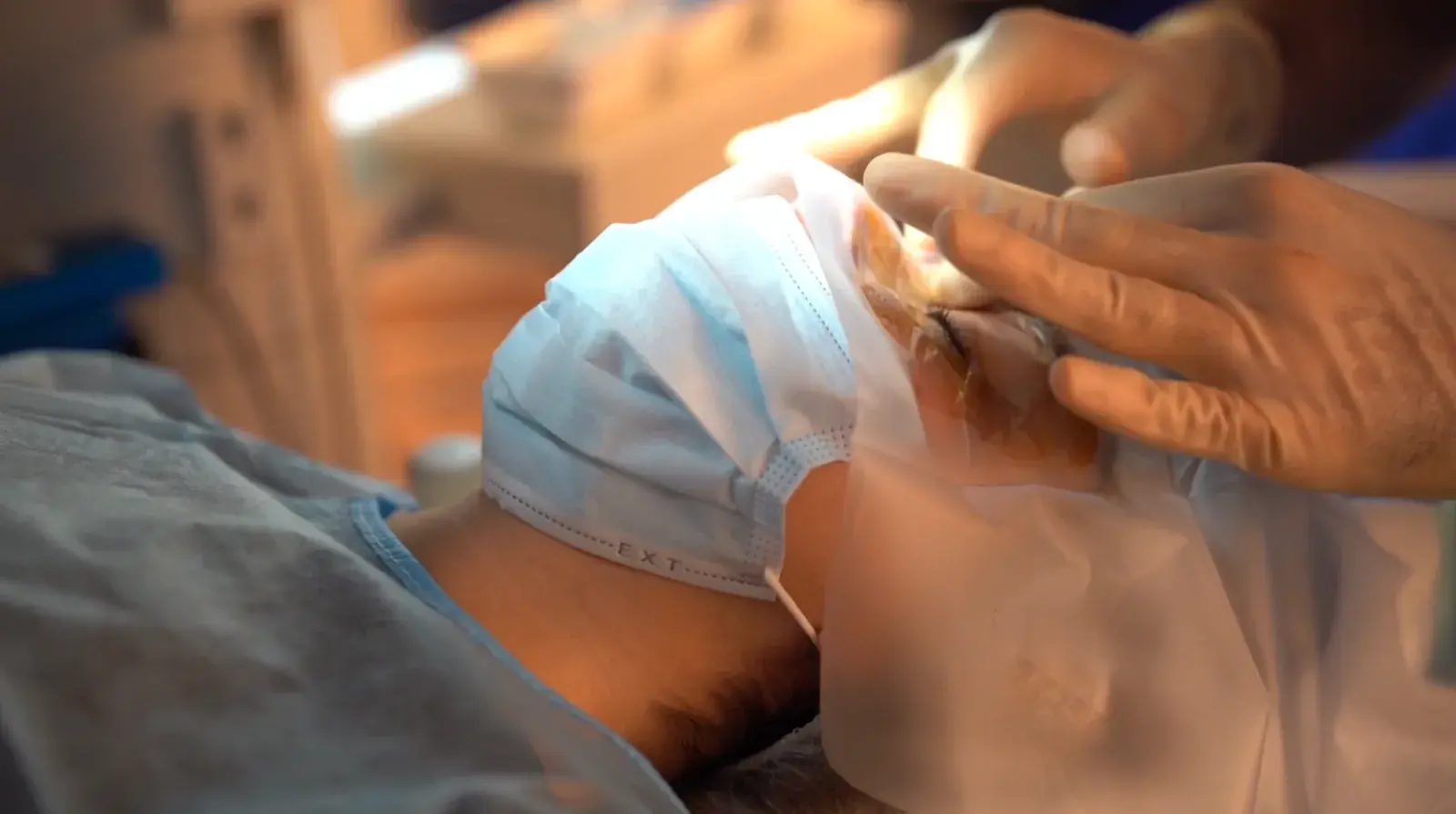Un patient allongé, le visage protégé par un champ stérile transparent, pendant qu'un chirurgien prépare son œil.